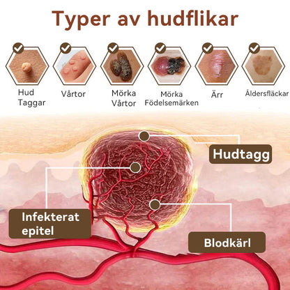 ✅【Officiell butik】🐼𝐃𝐢𝐚𝐩𝐚𝐬𝐨𝐧®𝐃𝐮𝐛𝐛𝐞𝐥𝐯𝐞𝐫𝐤𝐚𝐧𝐝𝐞 𝐀𝐧𝐥ä𝐠𝐠𝐧𝐢𝐧𝐠 𝐕å𝐫𝐭𝐛𝐨𝐫𝐭𝐭𝐚𝐠𝐧𝐢𝐧𝐠𝐬𝐤𝐫ä𝐦 👩‍⚕️(Effektiv för att ta bort födelsemärken, vårtor, hudflikar, pigmentfläckar och andra hudproblem)