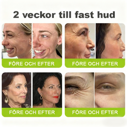 ✅𝑻𝒊𝒍𝒍𝒗𝒆𝒓𝒌𝒂𝒅 𝒐𝒄𝒉 𝒍𝒆𝒗𝒆𝒓𝒆𝒓𝒂𝒅 𝒇𝒓å𝒏 𝑺𝒗𝒆𝒓𝒊𝒈𝒆🍀𝑺𝑻𝑫𝑬𝑰® 𝑩𝒐𝒕𝒐𝒙 & 𝑽𝒊𝒕𝒂-𝑨 𝑹𝒆𝒕𝒊𝒏𝒐𝒍 𝑺𝒉𝒐𝒕 𝑹𝒚𝒏𝒌𝒍𝒚𝒇𝒕𝒂𝒏𝒅𝒆 𝑼𝒑𝒑𝒔𝒕𝒓𝒂𝒎𝒂𝒏𝒅𝒆 𝑲𝒓ä𝒎